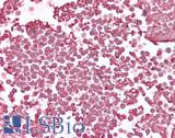 HBA1+2 / Hemoglobin Alpha Antibody - Human Red Blood Cells: Formalin-Fixed, Paraffin-Embedded (FFPE)