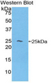 HBB / Hemoglobin Beta Antibody - Western blot of recombinant HBB / Hemoglobin Beta.  This image was taken for the unconjugated form of this product. Other forms have not been tested.