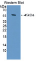 HBD / Hemoglobin Delta Antibody - Western blot of HBD / Hemoglobin Delta antibody.
