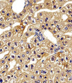 HBG2 / Hemoglobin Gamma 2 Antibody - Immunohistochemical of paraffin-embedded M. liver section using HBG2 Antibody. Antibody was diluted at 1:100 dilution. A peroxidase-conjugated goat anti-rabbit IgG at 1:400 dilution was used as the secondary antibody, followed by DAB staining.