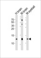 HBG2 / Hemoglobin Gamma 2 Antibody - Western blot of lysates from human brain, mouse brain and eyeball tissue lysate (from left to right) with HBG2 Antibody. Antibody was diluted at 1:1000 at each lane. A goat anti-rabbit IgG H&L (HRP) at 1:5000 dilution was used as the secondary antibody. Lysates at 35 ug per lane.