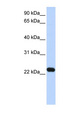 HBXIP Antibody - HBXIP antibody Western blot of Transfected 293T cell lysate. This image was taken for the unconjugated form of this product. Other forms have not been tested.