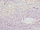 HBZ Antibody - Immunohistochemistry of paraffin-embedded Human spleen tissue at dilution 1:100