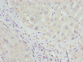 HBZ Antibody - Immunohistochemistry of paraffin-embedded Human liver tissue at dilution 1:100