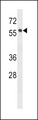 HCK Antibody - HCK Antibody (E8) western blot of human placenta tissue lysates (35 ug/lane). The HCK antibody detected the HCK protein (arrow).