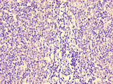 HCP5 Antibody - Immunohistochemistry of paraffin-embedded human lymph node tissue using HCP5 Antibody at dilution of 1:100