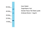 HCRT / Orexin Antibody -  This image was taken for the unconjugated form of this product. Other forms have not been tested.