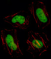 HDAC1 Antibody - Fluorescent image of HeLa cell stained with HDAC1 Antibody. HeLa cells were fixed with 4% PFA (20 min), permeabilized with Triton X-100 (0.1%, 10 min), then incubated with HDAC1 primary antibody (1:25, 1 h at 37°C). For secondary antibody, Alexa Fluor 488 conjugated donkey anti-rabbit antibody (green) was used (1:400, 50 min at 37°C). Cytoplasmic actin was counterstained with Alexa Fluor 555 (red) conjugated Phalloidin (7units/ml, 1 h at 37°C). HDAC1 immunoreactivity is localized to Nucleus significantly.