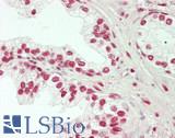 HDAC1 Antibody - Human Prostate: Formalin-Fixed, Paraffin-Embedded (FFPE)