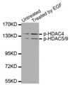 HDAC4/5/9 Antibody - Western blot analysis of extracts from 293 cells untreated or treated with EGF.