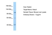 HDAC4 Antibody -  This image was taken for the unconjugated form of this product. Other forms have not been tested.