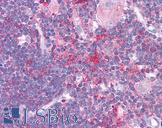 HDAC6 Antibody - Anti-HDAC6 antibody IHC of human thymus. Immunohistochemistry of formalin-fixed, paraffin-embedded tissue after heat-induced antigen retrieval. Antibody concentration 5 ug/ml.  This image was taken for the unconjugated form of this product. Other forms have not been tested.