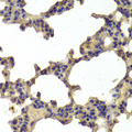 HDAC7 Antibody - Immunohistochemistry of paraffin-embedded Rat lung tissue.