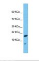 HDDC2 Antibody - Western blot of Human Ovary Tumor. HDDC2 antibody dilution 1.0 ug/ml.  This image was taken for the unconjugated form of this product. Other forms have not been tested.