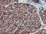 HDHD1 Antibody - IHC of paraffin-embedded Human pancreas tissue using anti-HDHD1 mouse monoclonal antibody.