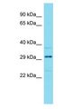 HEATR3 Antibody - HEATR3 antibody Western Blot of Fetal Kidney. Antibody dilution: 1 ug/ml.  This image was taken for the unconjugated form of this product. Other forms have not been tested.