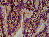 HECTD2 Antibody - Immunohistochemistry image at a dilution of 1:300 and staining in paraffin-embedded human small intestine tissue performed on a Leica BondTM system. After dewaxing and hydration, antigen retrieval was mediated by high pressure in a citrate buffer (pH 6.0) . Section was blocked with 10% normal goat serum 30min at RT. Then primary antibody (1% BSA) was incubated at 4 °C overnight. The primary is detected by a biotinylated secondary antibody and visualized using an HRP conjugated SP system.
