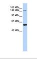 HEDLS / EDC4 Antibody - Fetal liver lysate. Antibody concentration: 1.0 ug/ml. Gel concentration: 6-18%.  This image was taken for the unconjugated form of this product. Other forms have not been tested.