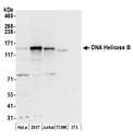 HELB Antibody - Detection of human and mouse DNA Helicase B by western blot. Samples: Whole cell lysate (50 µg) from HeLa, HEK293T, Jurkat, mouse TCMK-1, and mouse NIH 3T3 cells prepared using NETN lysis buffer. Antibodies: Affinity purified rabbit anti-DNA Helicase B antibody used for WB at 0.1 µg/ml. Detection: Chemiluminescence with an exposure time of 30 seconds.
