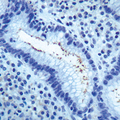 Helicobacter pylori Antibody - Formalin-fixed, paraffin-embedded human stomach infected with H. pylori and stained with H. pylori antibody.