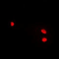 HELLS Antibody - Immunofluorescent analysis of Lsh staining in A549 cells. Formalin-fixed cells were permeabilized with 0.1% Triton X-100 in TBS for 5-10 minutes and blocked with 3% BSA-PBS for 30 minutes at room temperature. Cells were probed with the primary antibody in 3% BSA-PBS and incubated overnight at 4 deg C in a humidified chamber. Cells were washed with PBST and incubated with a DyLight 594-conjugated secondary antibody (red) in PBS at room temperature in the dark.