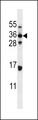 HELO1 / ELOVL5 Antibody - ELOVL5 Antibody western blot of MDA-MB435 cell line lysates (35 ug/lane). The ELOVL5 antibody detected the ELOVL5 protein (arrow).