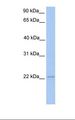 HEM45 / ISG20 Antibody - Jurkat cell lysate. Antibody concentration: 1.0 ug/ml. Gel concentration: 12%.  This image was taken for the unconjugated form of this product. Other forms have not been tested.