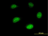 HEM45 / ISG20 Antibody - Immunofluorescence of monoclonal antibody to ISG20 on HeLa cell . [antibody concentration 10 ug/ml]