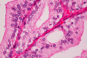 Prostate section stained with Hematoxylin & Eosin Stain Kit (cytoplasm, pink; nuclei, blue).
