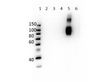 Hemoglobin Gamma (HBG1 + HBG2) Antibody - Western Blot of Mouse Anti-Hemoglobin beta F Antibody. Lane 1: Molecular Weight Ladder. Lane 2: HbA peptide conjugated to BSA. Lane 3: HbA-2 peptide conjugated to BSA. Lane 4: HbC peptide conjugated to BSA. Lane 5: HbF peptide conjugated to BSA. Lane 6: HbS peptide conjugated to BSA. Load: 50ng per lane. Primary antibody: Anti-HbF antibody at 1µg/mL overnight at 4°C. Secondary antibody: Rabbit Anti-Mouse secondary antibody at 1:40,000 for 30 min at RT. Block: MB-073 for 30 min RT. Predicted/Observed: Reactivity seen in Lane 5 specific to HbF only.
