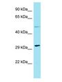 HENMT1 Antibody - HENMT1 antibody Western Blot of Jurkat. Antibody dilution: 1 ug/ml.  This image was taken for the unconjugated form of this product. Other forms have not been tested.