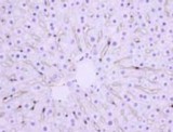 Hepatic Sinusoidal Endothelial Cells Antibody - Western Blot: Hepatic Sinusoidal Endothelial Cells Antibody (SE-1) - IHC of Hepatic Sinusoidal Endothelial Cells in rat liver.  This image was taken for the unconjugated form of this product. Other forms have not been tested.