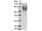 HCV E2 Protein - Recombinant HCV (serotype 1c,isolate HC-G9) E2 Protein (His Tag)