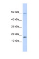 HERC4 Antibody - HERC4 antibody Western blot of Fetal Liver lysate. Antibody concentration 1 ug/ml. This image was taken for the unconjugated form of this product. Other forms have not been tested.