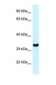 HEY1 Antibody - HEY1 antibody Western blot of Rat Muscle lysate. Antibody concentration 1 ug/ml.  This image was taken for the unconjugated form of this product. Other forms have not been tested.