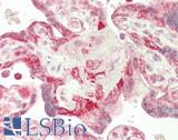 HEY1 Antibody - Human Placenta: Formalin-Fixed, Paraffin-Embedded (FFPE)