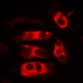 HFE Antibody - Immunofluorescent analysis of HFE staining in MCF7 cells. Formalin-fixed cells were permeabilized with 0.1% Triton X-100 in TBS for 5-10 minutes and blocked with 3% BSA-PBS for 30 minutes at room temperature. Cells were probed with the primary antibody in 3% BSA-PBS and incubated overnight at 4 deg C in a humidified chamber. Cells were washed with PBST and incubated with a DyLight 594-conjugated secondary antibody (red) in PBS at room temperature in the dark.