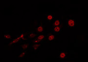 HFH-4 / FOXJ1 Antibody - Staining LOVO cells by IF/ICC. The samples were fixed with PFA and permeabilized in 0.1% Triton X-100, then blocked in 10% serum for 45 min at 25°C. The primary antibody was diluted at 1:200 and incubated with the sample for 1 hour at 37°C. An Alexa Fluor 594 conjugated goat anti-rabbit IgG (H+L) Ab, diluted at 1/600, was used as the secondary antibody.