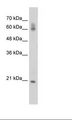 HFip1 / FIP1L1 Antibody - Jurkat Cell Lysate.  This image was taken for the unconjugated form of this product. Other forms have not been tested.