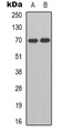 HGFAC / HGFA Antibody - Western blot analysis of HGF activator expression in K562 (A); Jurkat (B) whole cell lysates.