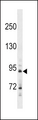 HHIP / HIP Antibody - HHIP Antibody western blot of A549 cell line lysates (35 ug/lane). The HHIP antibody detected the HHIP protein (arrow).