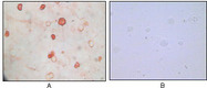 HHV-8 K8 alpha Antibody - ICC of TPA induced BCBL-1 cells (A) and uninduced BCBL-1 cells (B) using KSHV K8a mouse monoclonal antibody with AEC staining.