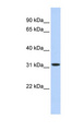 HIBADH Antibody - HIBADH antibody Western blot of Fetal Liver lysate. This image was taken for the unconjugated form of this product. Other forms have not been tested.