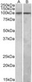 HIC1 Antibody - HIC1 antibody (1 ug/ml) staining of A549 (A) and Jurkat (B) lysates (35 ug protein in RIPA buffer). Primary incubation was 1 hour. Detected by chemiluminescence.