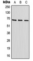 HIC2 Antibody - Western blot analysis of HIC2 expression in HepG2 (A); HeLa (B); NIH3T3 (C) whole cell lysates.