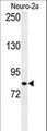 HID1 / C17orf28 Antibody - Western blot of CQ028 Antibody in Neuro-2a cell line lysates (35 ug/lane). CQ028 (arrow) was detected using the purified antibody.