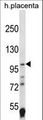 HIF2A / EPAS1 Antibody - EPAS1 Antibody western blot of human placenta tissue lysates (35 ug/lane). The EPAS1 antibody detected the EPAS1 protein (arrow).