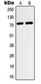 HIF3A / HIF3-Alpha Antibody - Western blot analysis of HIF3 alpha expression in HeLa (A); HepG2 (B) whole cell lysates.