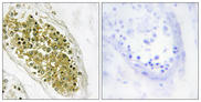 HIPK4 Antibody - Immunohistochemistry analysis of paraffin-embedded human testis tissue, using HIPK4 Antibody. The picture on the right is blocked with the synthesized peptide.