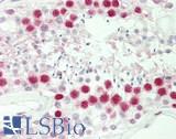 HIST1H1C Antibody - Human Testis: Formalin-Fixed, Paraffin-Embedded (FFPE).  This image was taken for the unconjugated form of this product. Other forms have not been tested.